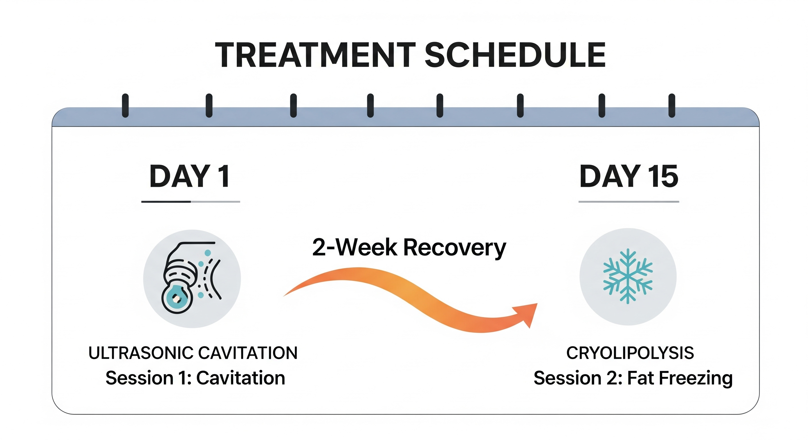 Calendar showing treatment sequence of cavitation followed by cryo